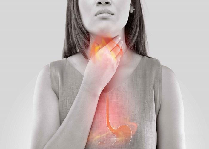 Gastroesophageal Reflux Disease (GERD) Symptoms, Treatment, Causes, and Diagnosis – Everything You Need to Know About