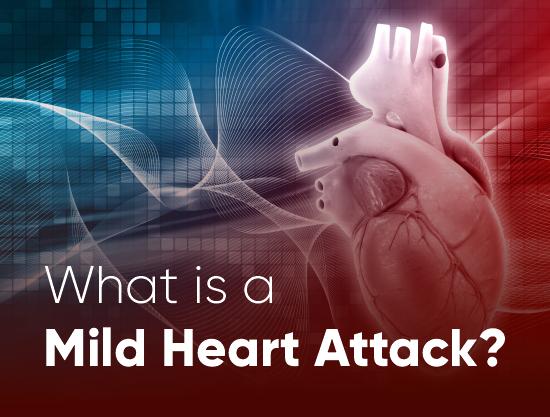 What is a Mild Heart Attack?